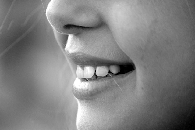 zęby mądrości - leczyć czy wyrwać