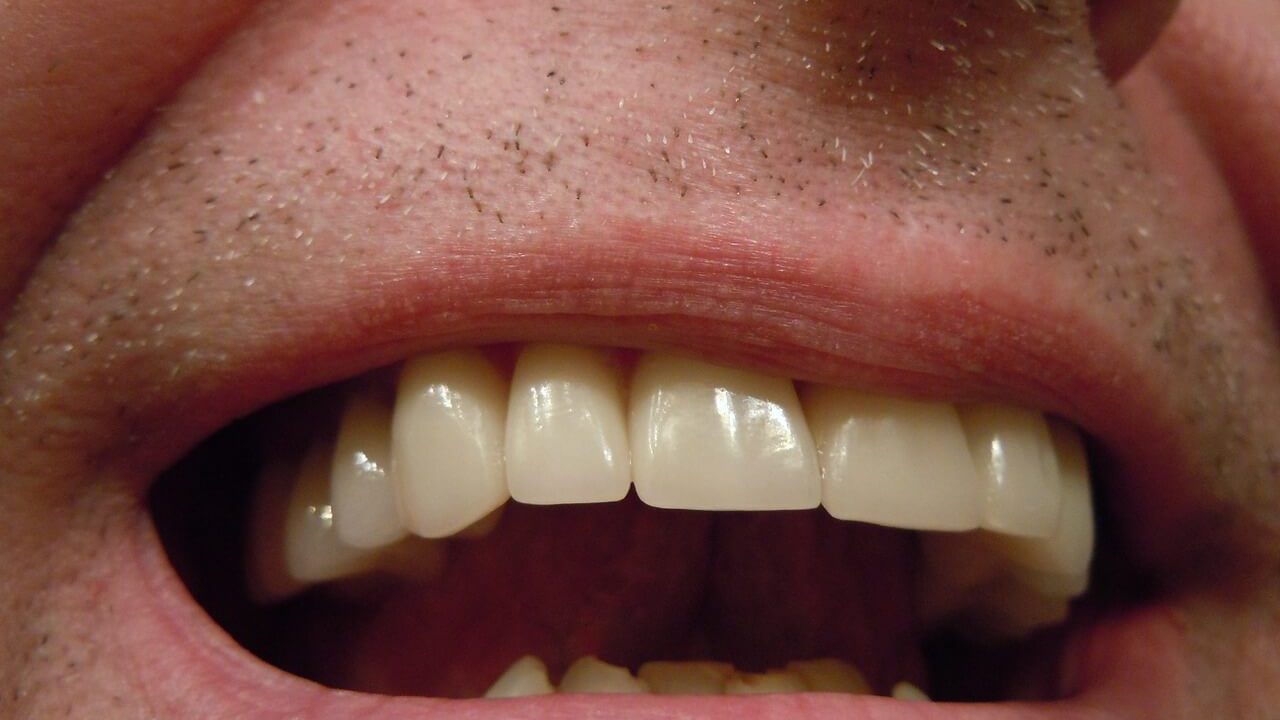 Przebarwienia zębów przy dziąsłach